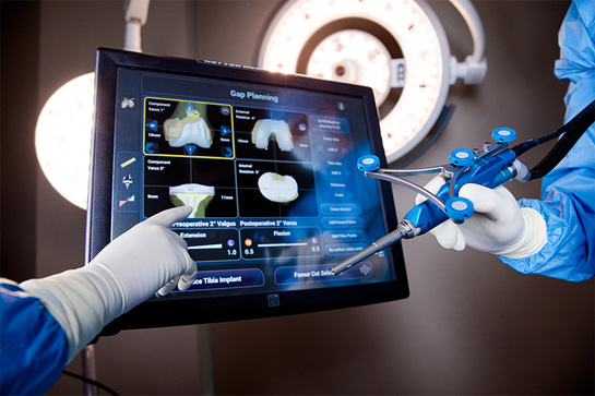 Νέο Σύστημα Ρομποτικής Χειρουργικής για τις Ορθοπεδικές Επεμβάσεις στο ΟΛΥΜΠΙΟΝ